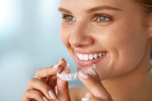 Teeth Straightening in Castle Hill & Edgecliff